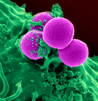 Everything You Need to Know About Methicillin-Resistant Staphylococcus ...