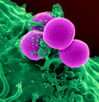 Everything You Need to Know About Methicillin-Resistant Staphylococcus Aureus (MRSA)